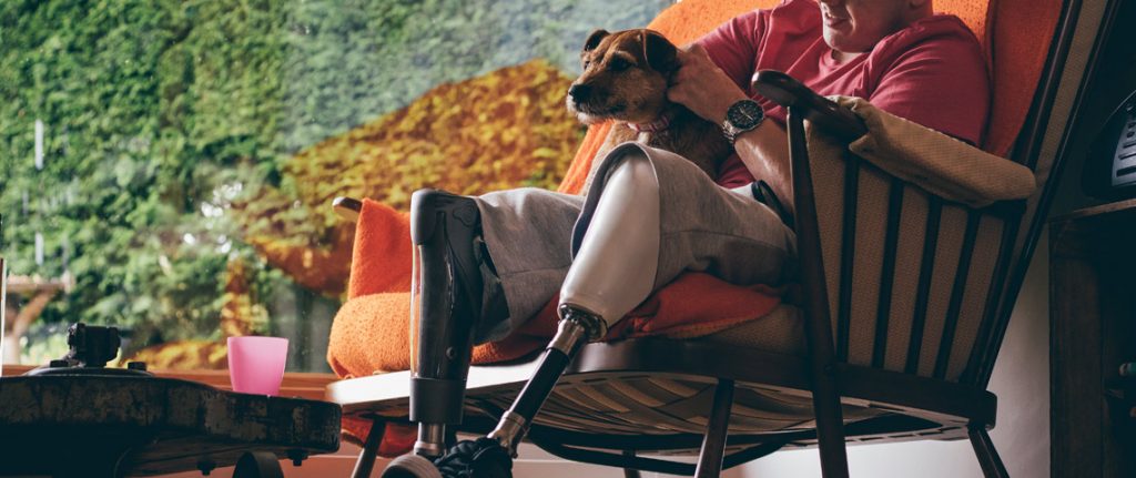 Mann med benprotese sitter i stol med hund på fanget